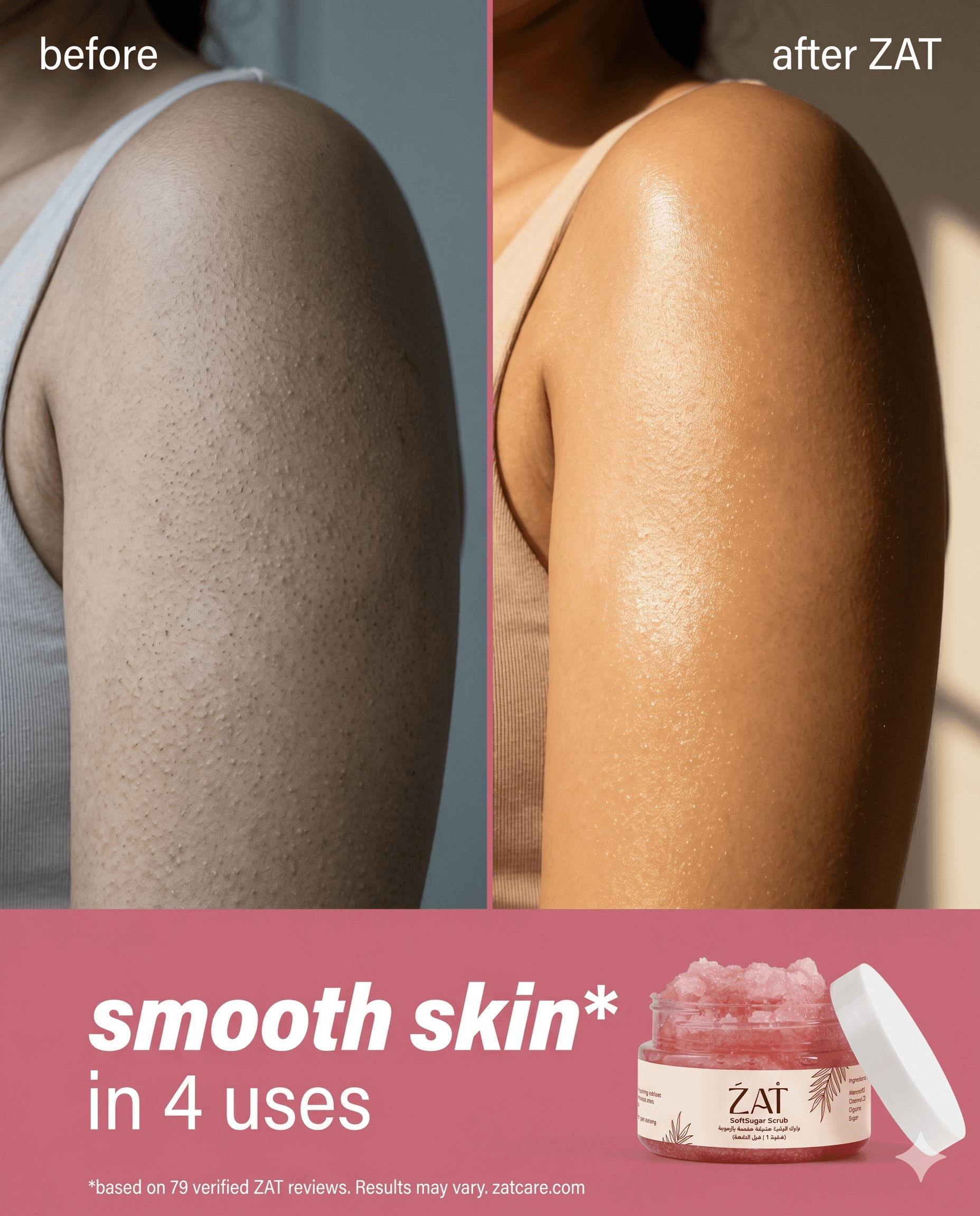 Zatcare — Samples 18